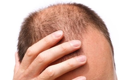 7 loại thực phẩm ngăn ngừa rụng tóc